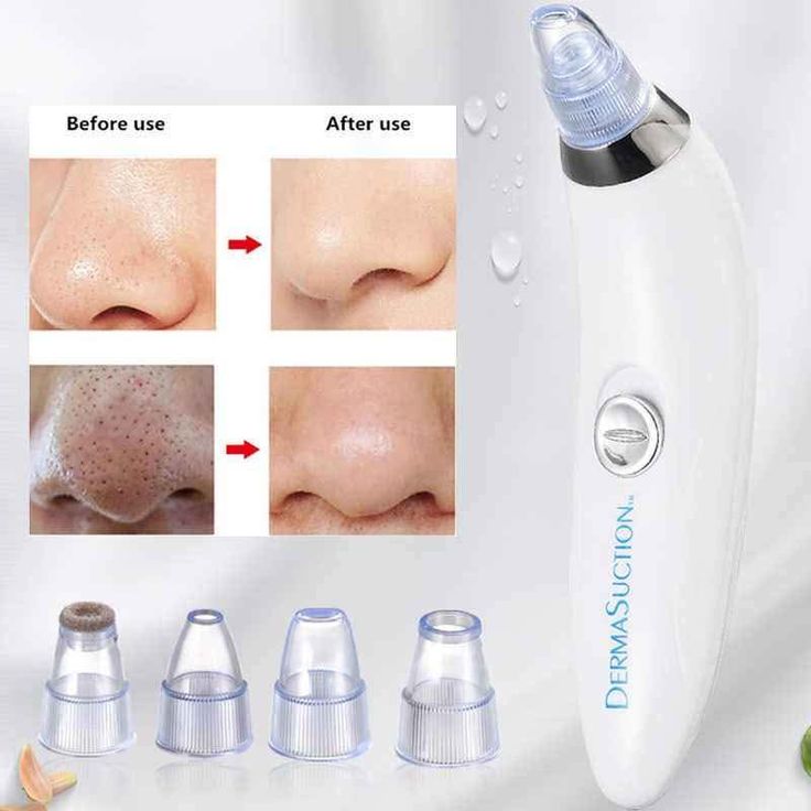 Electric Blackhead Remover